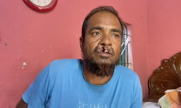 বিএনপি নেতার ‘দাঁত ফেলে দিলেন’ আওয়ামী লীগ নেতা